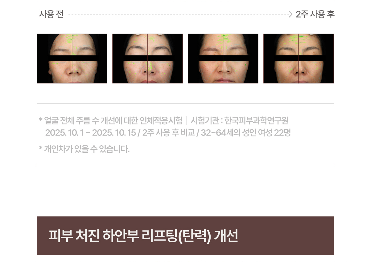 셀루닉 엔케이 액티베이터 크림