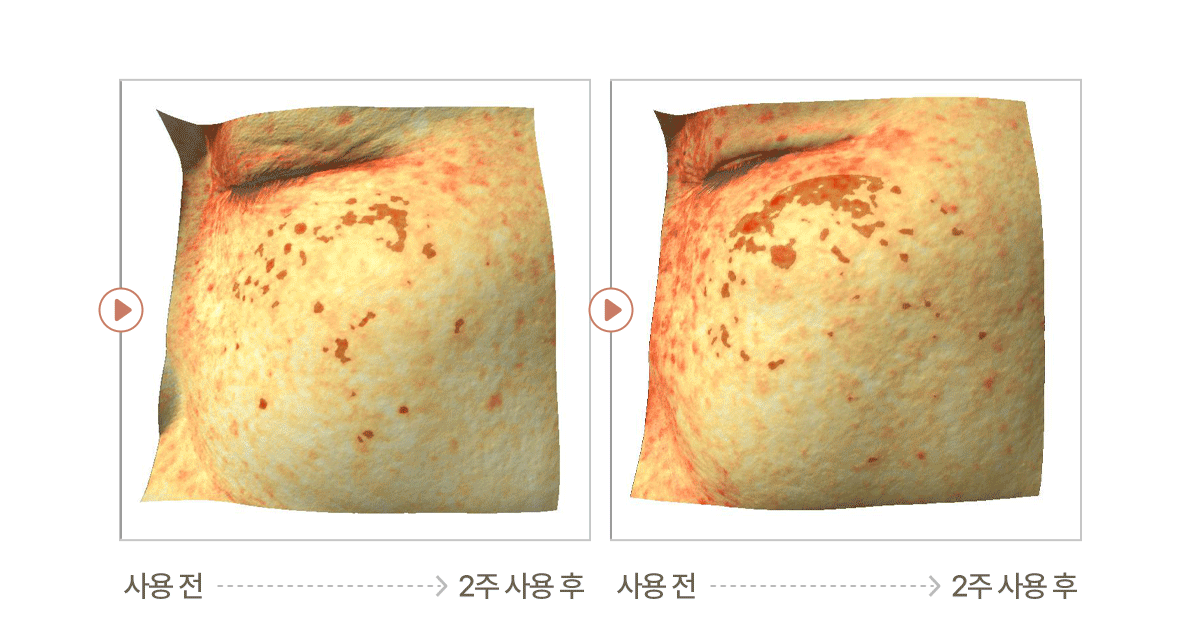 셀루닉 엔케이 액티베이터 앰플