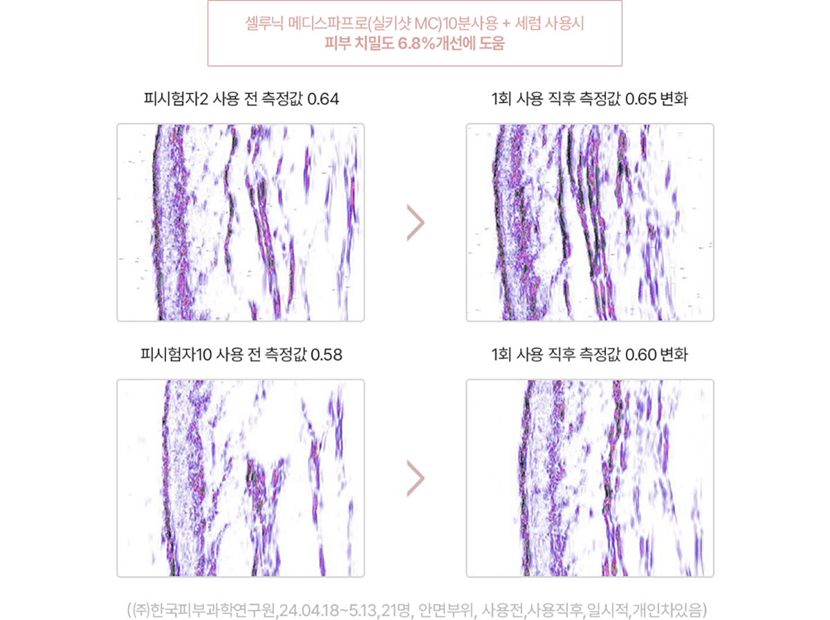 메디스파프로